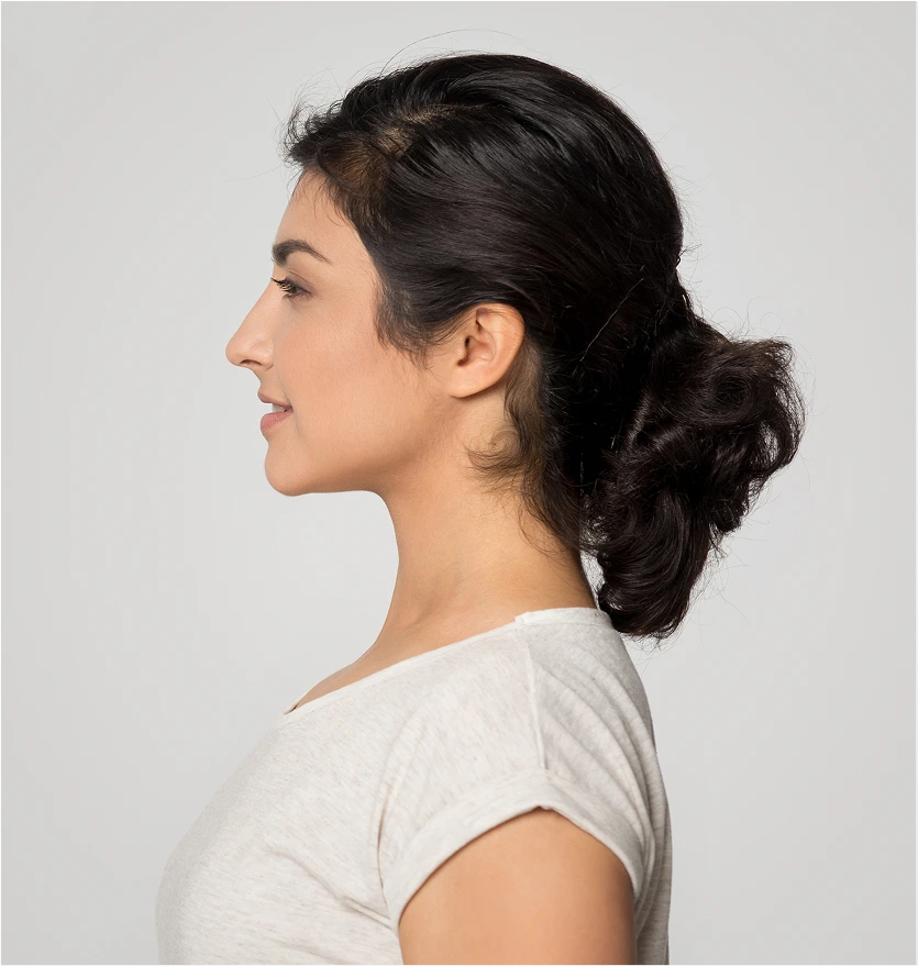 Benefits of Buffalo Hump Liposuction Denver CO Banner